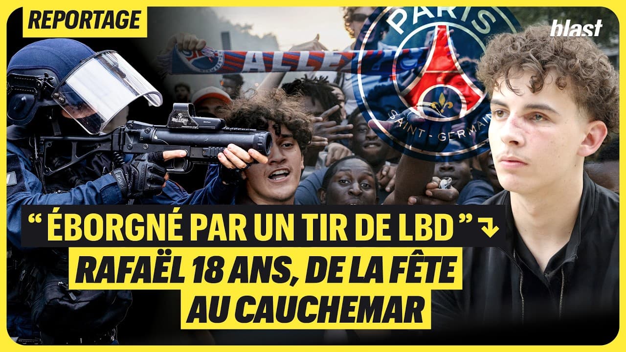 Un jeune de 18 ans perd un œil après un tir de LBD lors de la fête du PSG